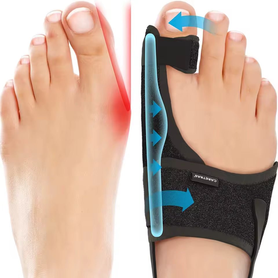 Correttore Ergonomico per Hallux Valgus – Supporto Regolabile per la Correzione delle Dita per Piedi Senza Dolore